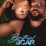 beautiful-scar